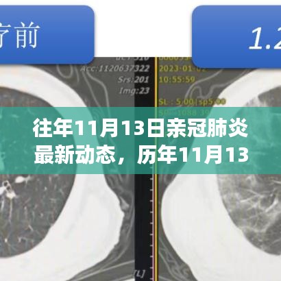 歷年11月13日新冠肺炎動態(tài)回顧，最新進展、當前動態(tài)與未來展望