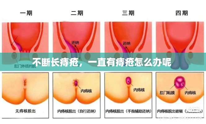 不斷長痔瘡，一直有痔瘡怎么辦呢 